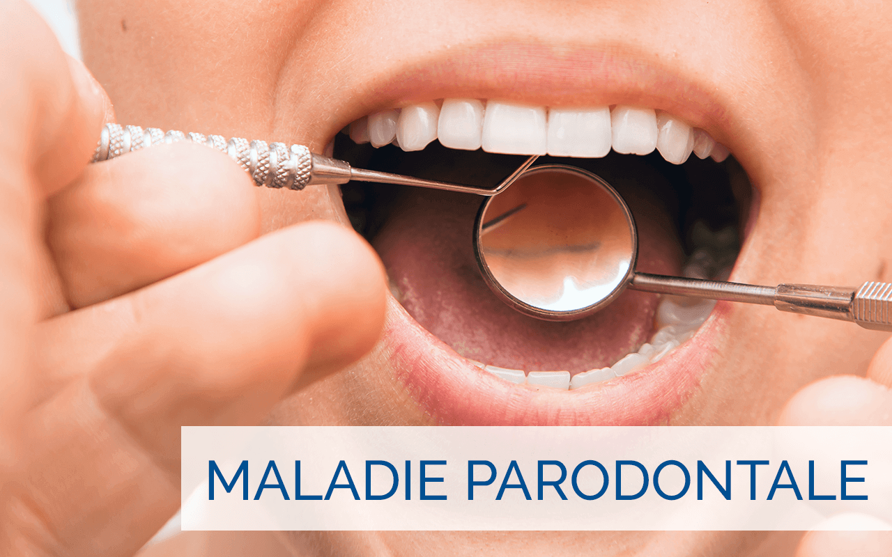 Maladie Parodontale Association Des Parodontistes Du Québec